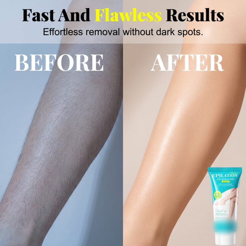 🔥HOT SALE 50% OFF! Gentle Hair Removal Cream with Hyaluronic Acid
